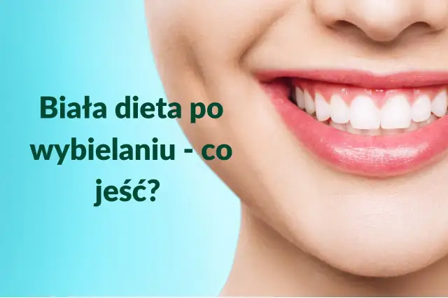 Biała dieta po wybielaniu zębów - Co jeść, by nie zepsuć efektu?