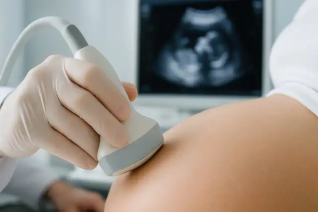 Dłoń w rękawiczce medycznej przykłada sondę USG do brzucha ciężarnej. Na ekranie widoczny obraz płodu.