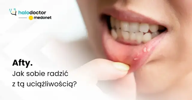 Choroby jamy ustnej: Jaki lekarz? Znajdź właściwego specjalistę!