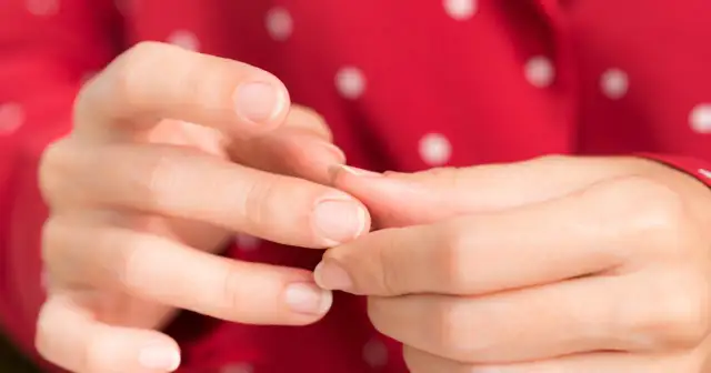 Zadziory przy paznokciach? Sprawdź, jakich witamin brakuje!