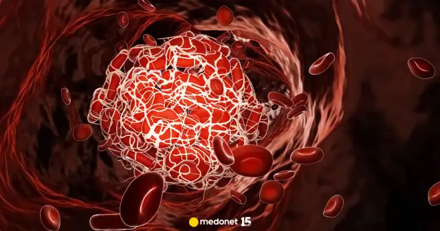 Captopril: Na co naprawdę pomaga? Zrozum jego działanie