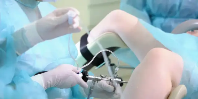 Alkohol po histeroskopii: Kiedy można pić?