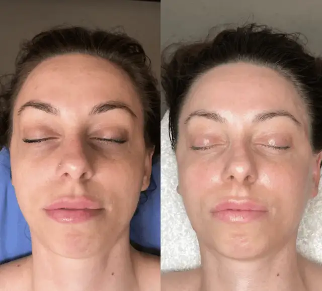 Masaż Kobido: Japoński lifting twarzy efekty, cena, opinie