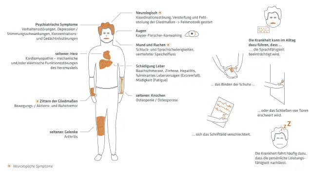 Morbus Wilson Diagnose: Schritte, Tests & Symptome erklärt