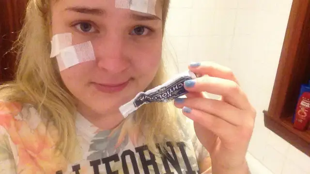 Maść ichtiolowa na pryszcze: Jak bezpiecznie i skutecznie stosować?