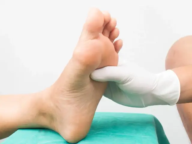 Skręcenie śródstopia: objawy, leczenie i kiedy do lekarza?