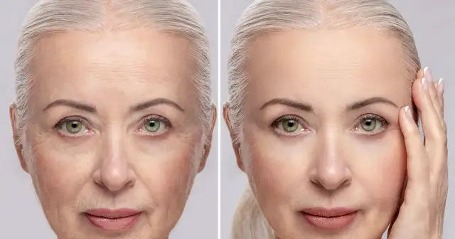 Kremy z efektem flash: Szybkie wygładzenie zmarszczek przed wyjściem