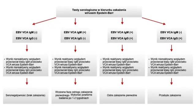 Mononukleoza zakaźna: Badania krwi i interpretacja. Czy to ona?