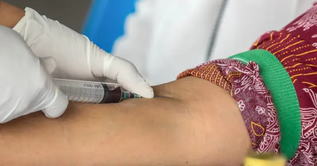 Twój HDL za niski? Jak podnieść dobry cholesterol naturalnie