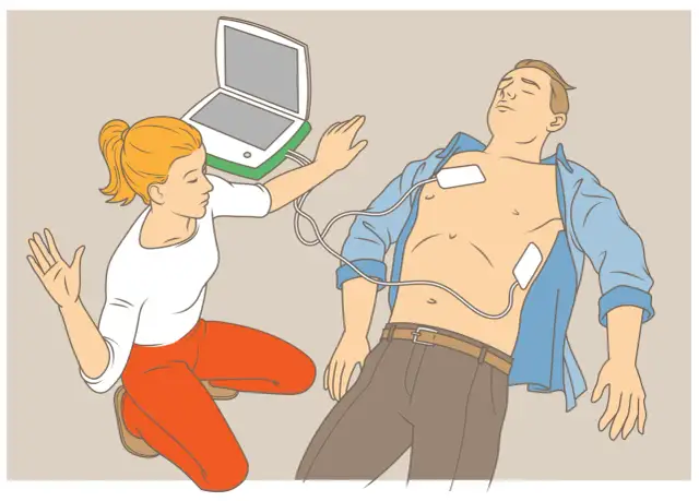 Ile uciśnięć RKO? Poznaj schemat 30:2 i ratuj życie!