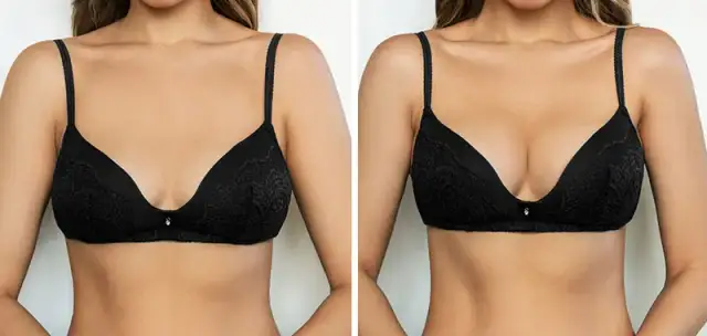 Powiększanie biustu - gdzie najtaniej i bezpiecznie? Porównanie cen