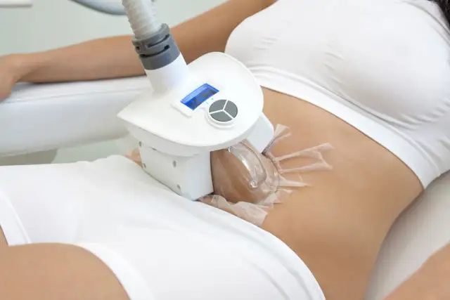 Odchudzanie bez diety i ćwiczeń – kriolipoliza