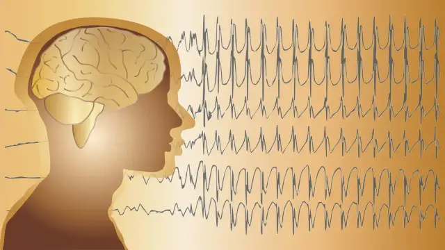 Skutki uboczne depakiny: Poważne ryzyka, które warto znać przed terapią