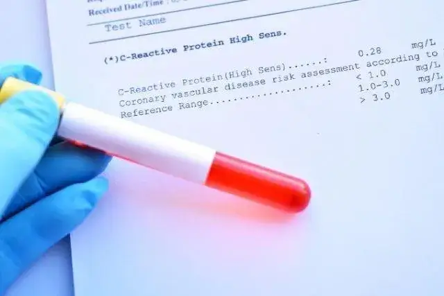Badanie CRP: Zrozum swój wynik i normy. Co oznacza?