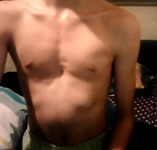 Lejkowata klatka piersiowa: jakiego lekarza potrzebujesz do leczenia?