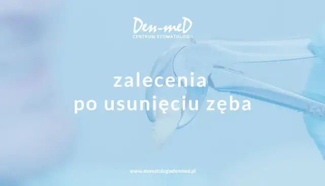 Antybiotyk po wyrwaniu zęba: Kiedy TAK, a kiedy NIE?