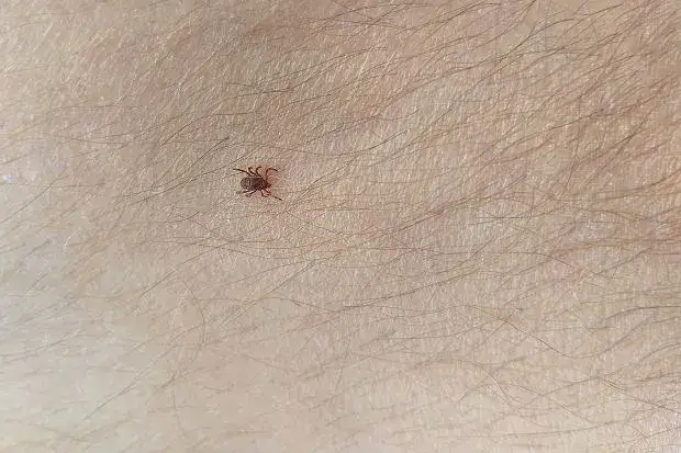 Kleszcz czy pieprzyk? Sprawdź, zanim spanikujesz! Ekspert radzi