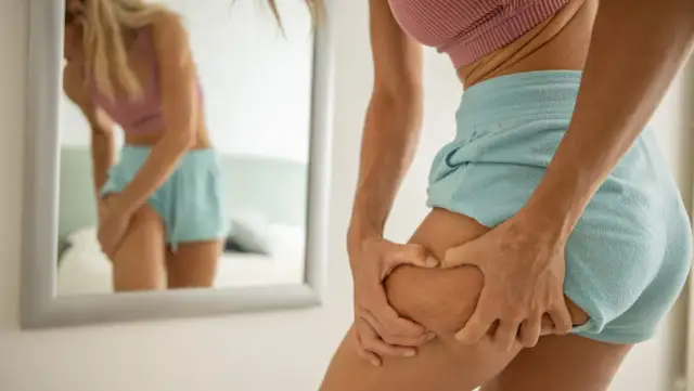 Cellulite bekämpfen: Die besten Übungen & Tipps für straffe Haut