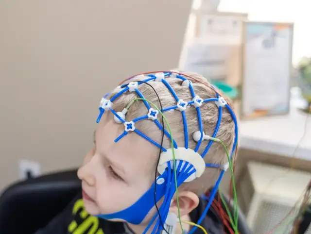 Ile trwa badanie EEG we śnie? Czas i przygotowanie krok po kroku