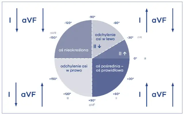 Lewogram patologiczny EKG: Co to znaczy? Przyczyny i co dalej