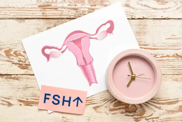 FSH powyżej 30-40 mIU/ml: Czy to menopauza? Zrozum wyniki