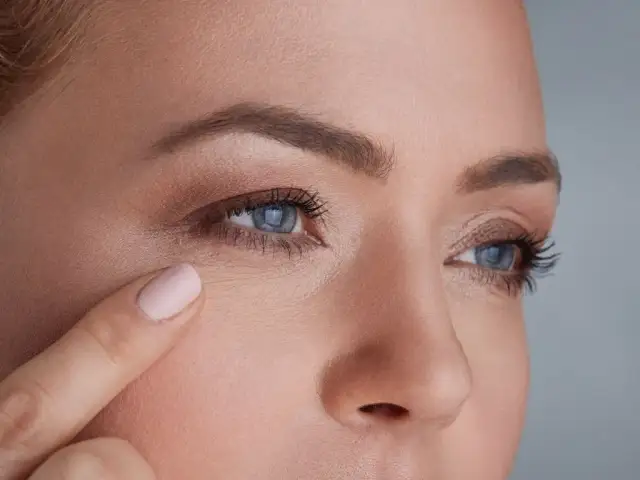 Ile kosztuje botoks pod oczy? Cena, efekty i czy warto?