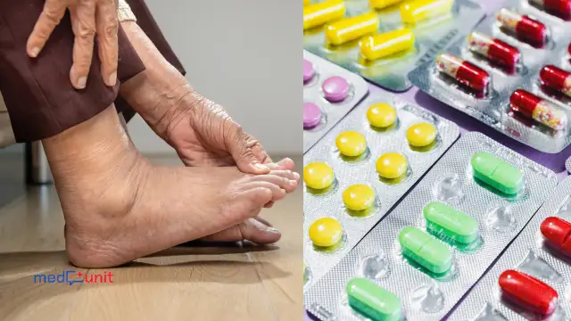 Dna moczanowa: Szybka ulga bez recepty i kiedy iść do lekarza?