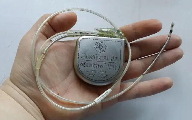 Dłoń trzyma kardiowerter Medtronic Maximo DR, urządzenie podobne do rozrusznika serca, z dwoma elektrodami.
