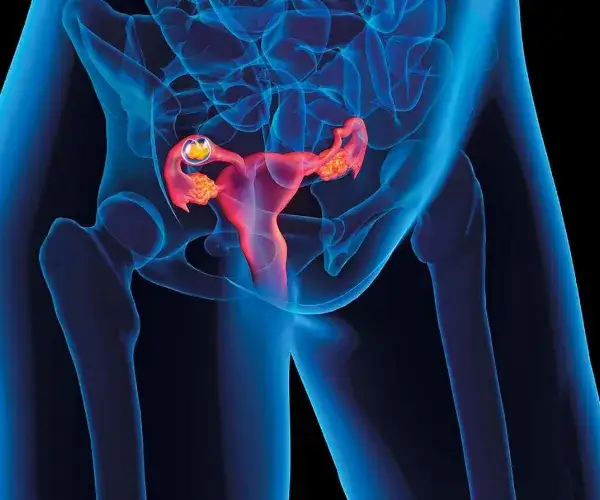 Po ciąży pozamacicznej: objawy, rekonwalescencja i nadzieja na przyszłość