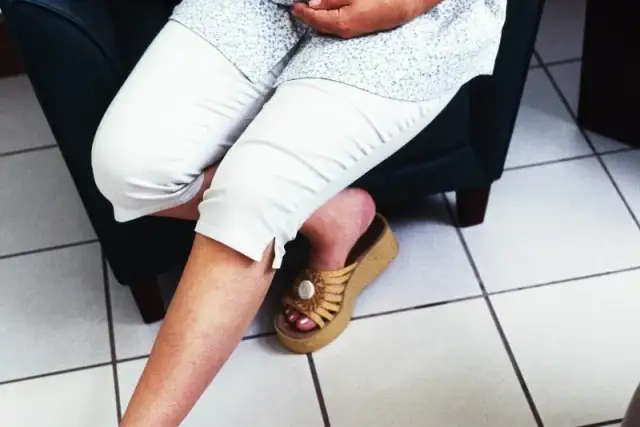 Czy w ciąży można chodzić na obcasach? Sprawdź, co musisz wiedzieć