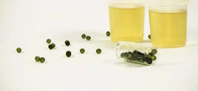 Co mogą odsłonić badania metaboliczne OAT? Poznaj możliwości.