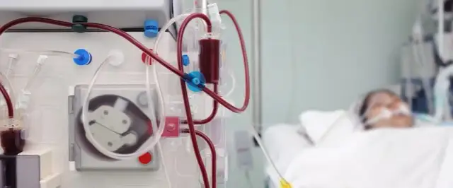 Skutki uboczne dializy nerek: Co powinni wiedzieć pacjenci?