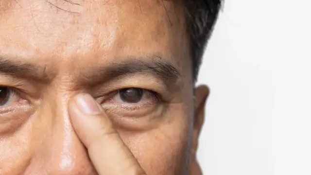 Zaćma – nie musi oznaczać pogorszenia jakości życia. Poznaj nowoczesne metody leczenia.