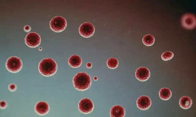 Co oznacza LYM w badaniu krwi? Normy, przyczyny odchyleń i ich znaczenie