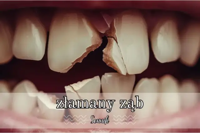 Znaczenie złamanego zęba w senniku - Co przepowiada ten niepokojący sen