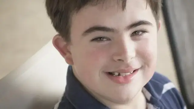 Ile chromosomów ma człowiek z zespołem Downa? Poznaj zaskakujące fakty