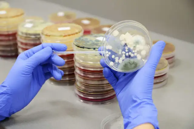 Grzybica jelit: Jakie badania pomogą w diagnozie kandydozy?