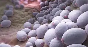 Candida - jakie objawy wskazują na zakażenie grzybicze?