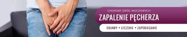 Zapalenie pęcherza: do ginekologa czy internisty? Kto pomoże szybciej?