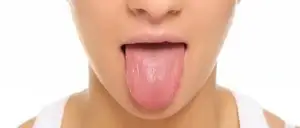 Kandydoza - charakterystyka choroby i objawy zakażenia