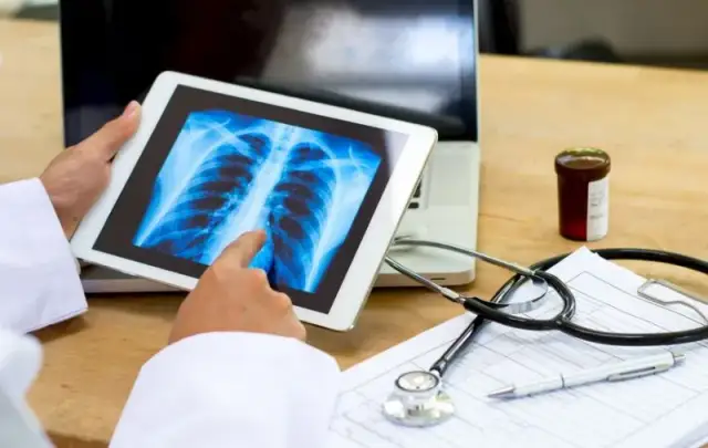 Objawy guzów płuc – co musisz wiedzieć, aby nie przegapić sygnałów