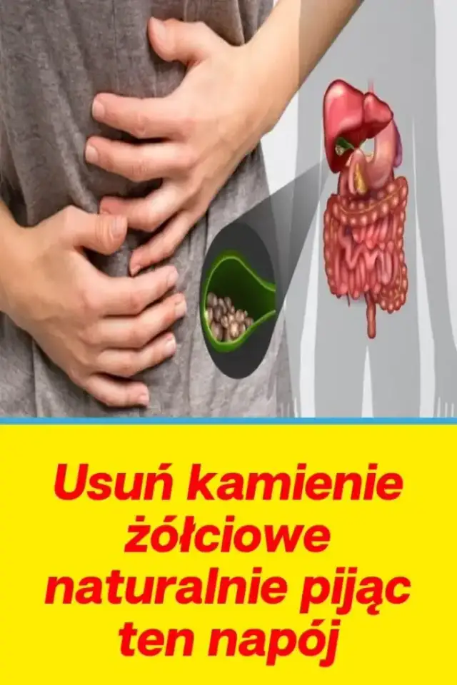 Skuteczne leki na kamienie żółciowe: Jak uniknąć bolesnej operacji