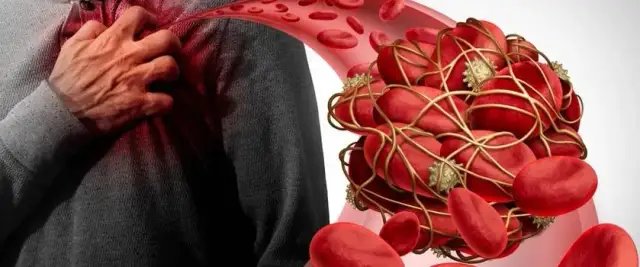 Dimery - co to za badanie i co może oznaczać dla zdrowia?