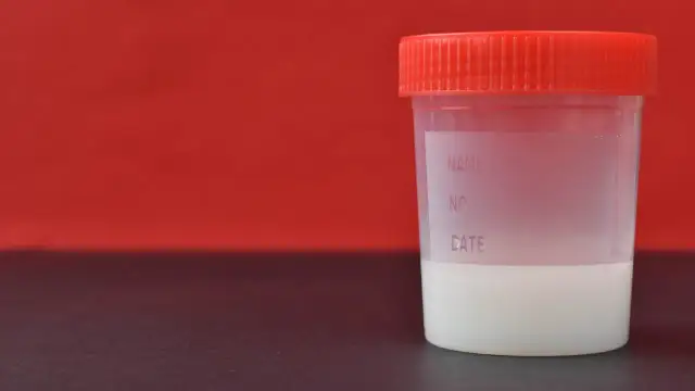 Bank spermy: ile realnie można zarobić na regularnym oddawaniu nasienia