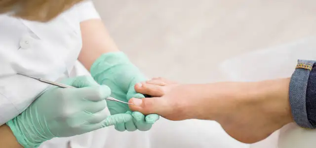 Jak wygląda wrośnięty paznokieć i jak uniknąć bólu oraz powikłań