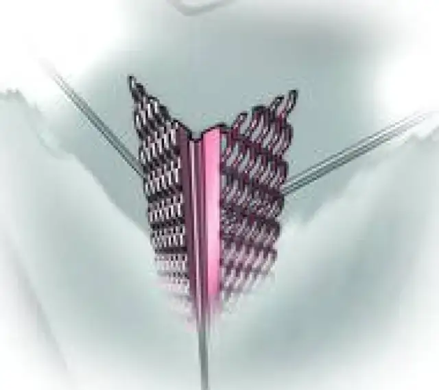 Jakie narożniki do tynków gipsowych wybrać, by uniknąć problemów?