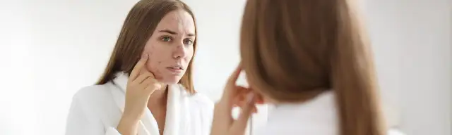 Krem do cery suchej z wypryskami – jak wybrać najlepszy produkt?