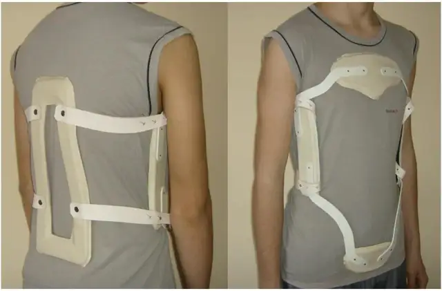 Gorset ortopedyczny na złamanie kręgosłupa: skuteczna stabilizacja