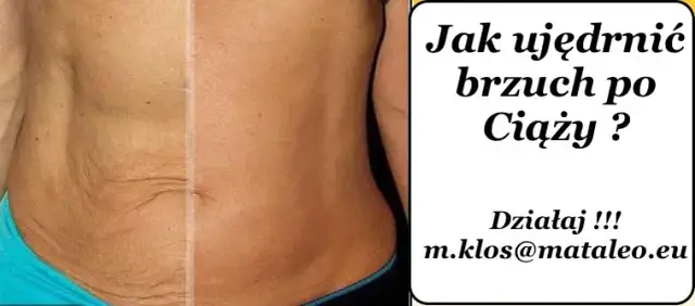 Jak ujędrnić brzuch po ciąży i odzyskać pewność siebie w sobie