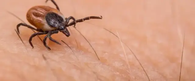 Kleszcz u człowieka co robić: skuteczne metody usuwania i zabezpieczenia